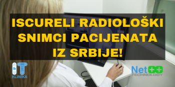 Iscureli radiološki snimci pacijenata iz Srbije! Iscureli radiološki snimci pacijenata iz Srbije!
